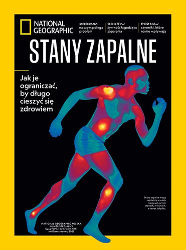 National Geographic Nr Spec. 1/2026 - Stany zapalne